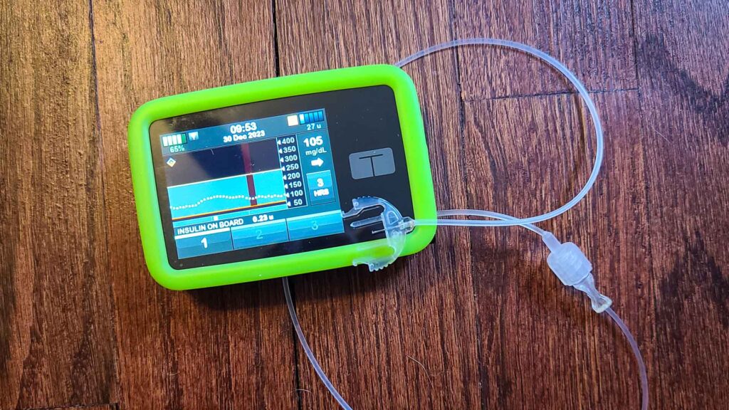 Tandem t:slim X2 insulin pump in a green case with a Trusteel infusion set attached